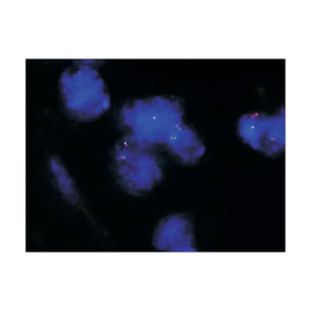 Abnova&trade;&nbsp;Sonde FISH de fragmentation TFE3