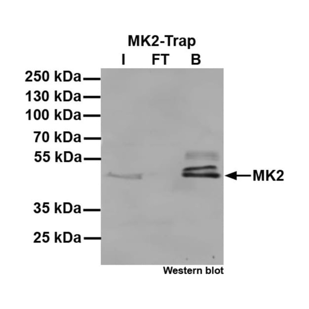 Proteintech&nbsp;Kit d’agarose ChromoTek MK2-Trap