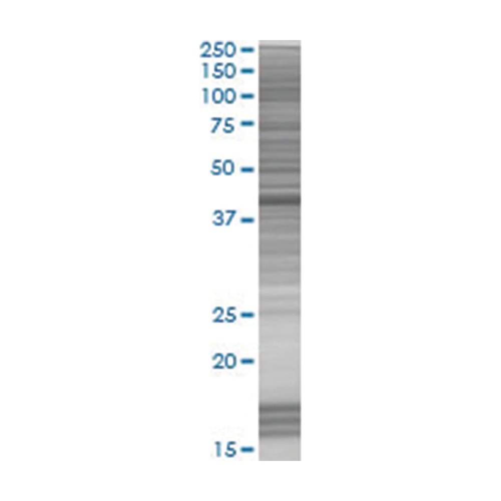 Lysat de surexpression SORBS3 en cellules 293T (dénaturé), Abnova