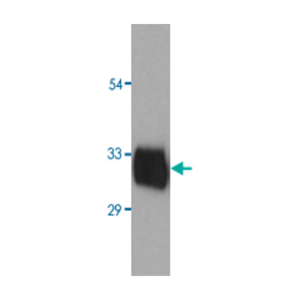Abnova&trade;&nbsp;Human KLK3 native Protein from human seminal plasma