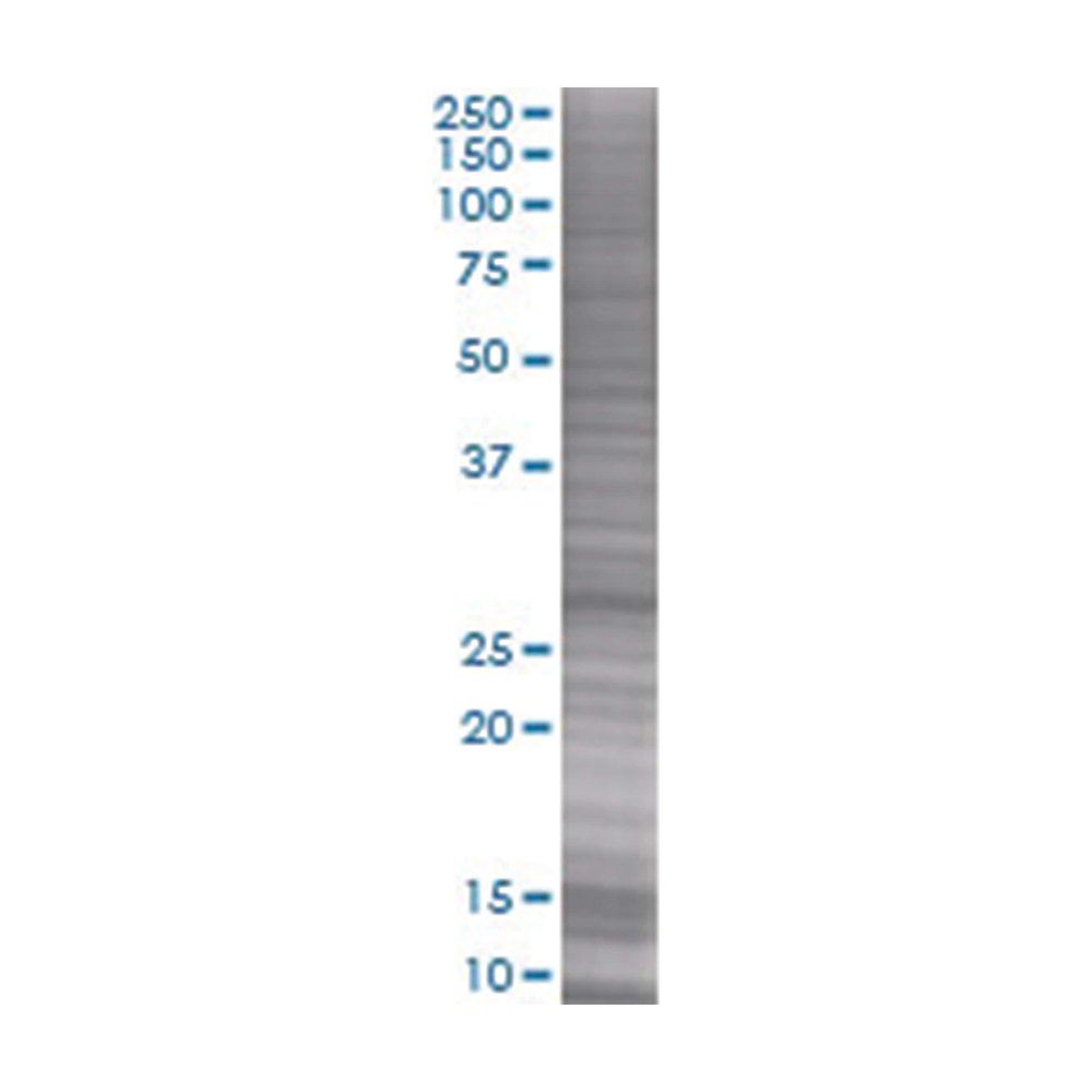 Lysat de surexpression RAB23 en cellules 293T 1 (dénaturé), Abnova