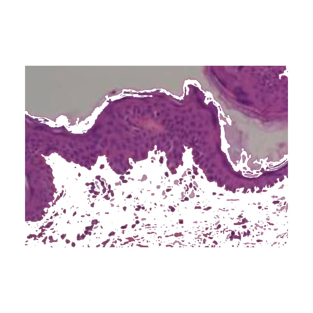 Novus Biologicals&trade;&nbsp;Micro-réseau de tissus (TMA) humains multi-tissus (cancer)