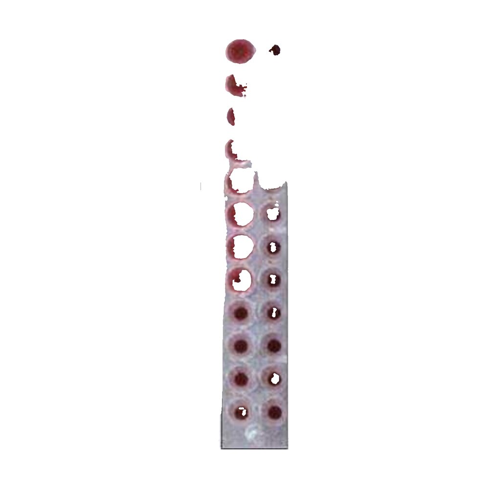 Novus Biologicals&trade;&nbsp;Ulex Europaeus Lectin 1 Native Protein