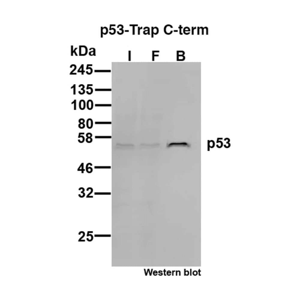 Proteintech&nbsp;Kit d’agarose ChromoTek p53 C-term-Trap