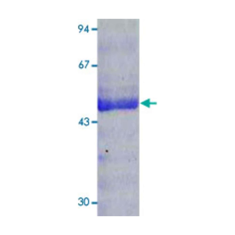 Abnova&trade;&nbsp;Human MMP1 native Protein from human fibroblasts