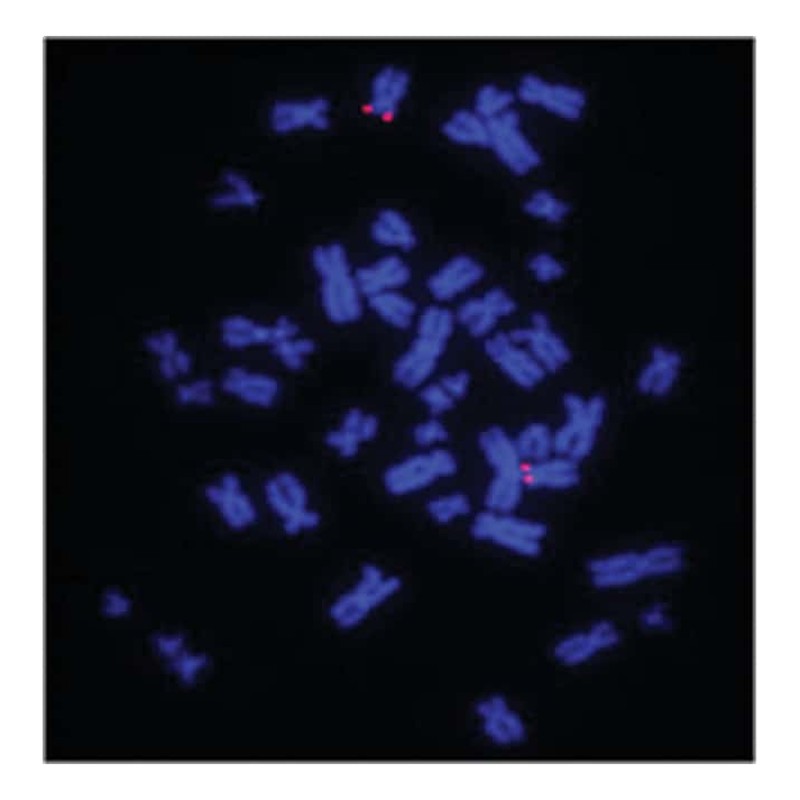 Réactifs pour hybridation fluorescente in situ