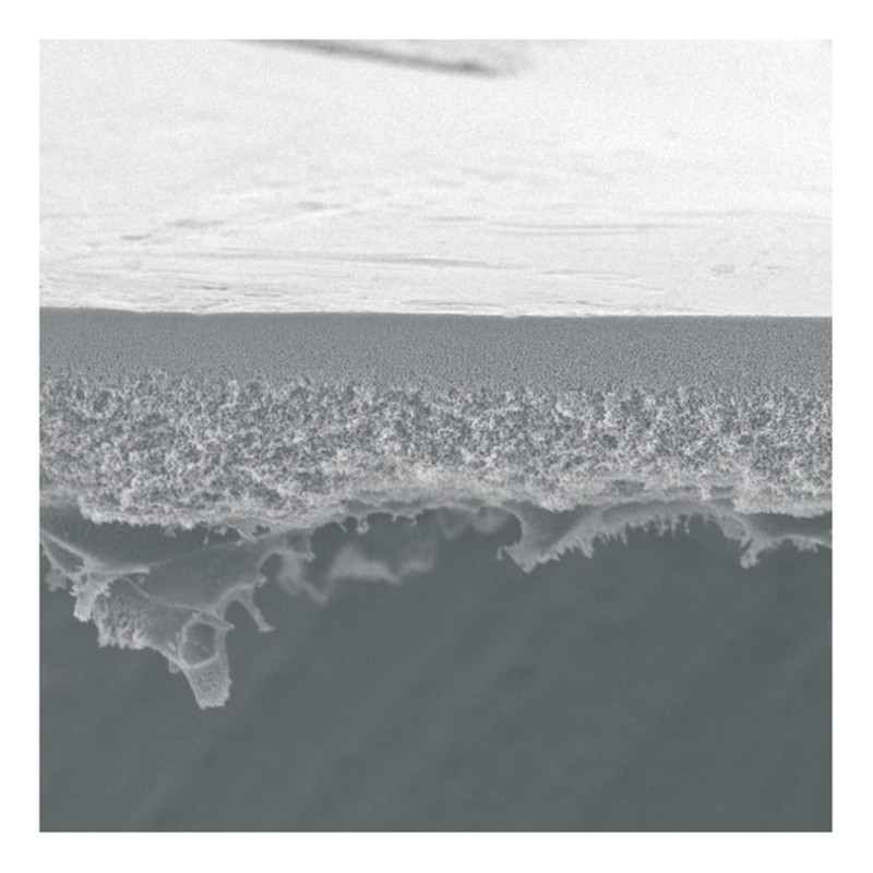 Filtres et dispositifs d’ultrafiltration